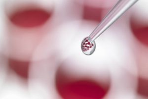 تزریق سلول بنیادی؛ گامی نو در پزشکی بازساختی و ترمیم بافت های بدن