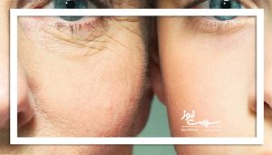 چرا برخی پیرتر از سن واقعی خود نشان می‌دهند؟