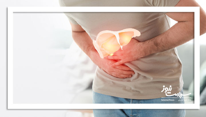 ۵ نشانه روی صورت که می‌تواند نشان‌دهنده کبد چرب باشد