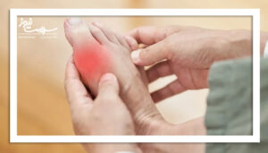 داروهای نقرس به سلامت قلب نیز کمک می‌کنند