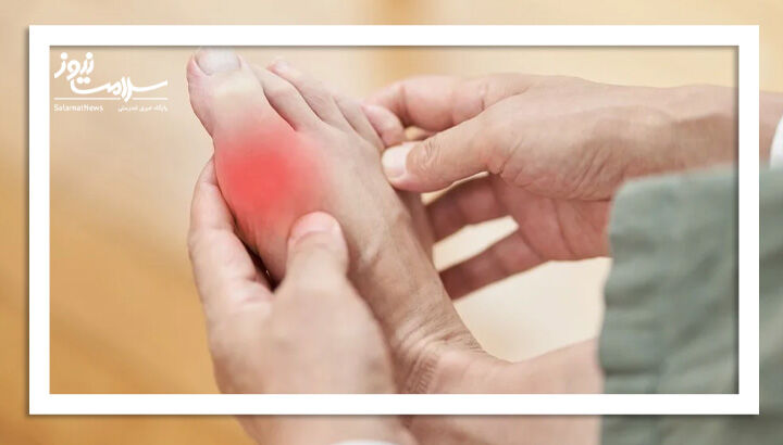 داروهای نقرس به سلامت قلب نیز کمک می‌کنند