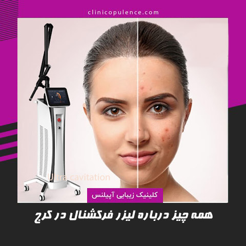 معجزه لیزر فرکشنال co2 در لاغری و زیبایی سال 2026